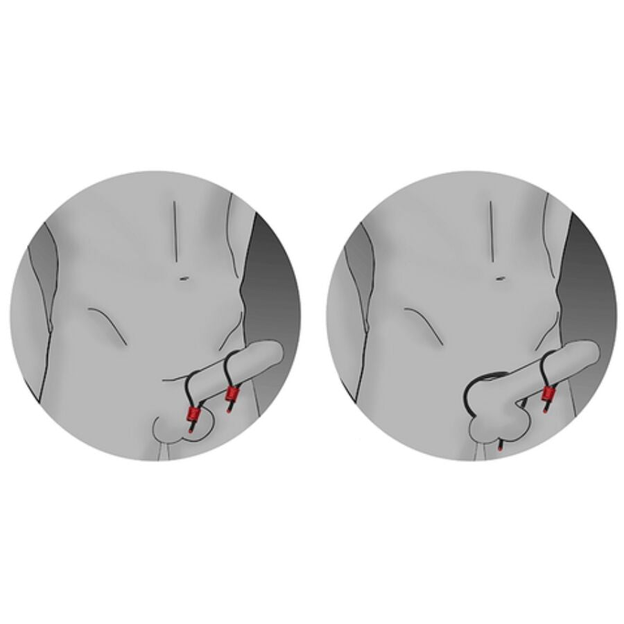 ELECTRASTIM ANeIS PENIANOS AJUSTaVEIS PRESTIGE ELECTRA LOOPS VERMELHOS
